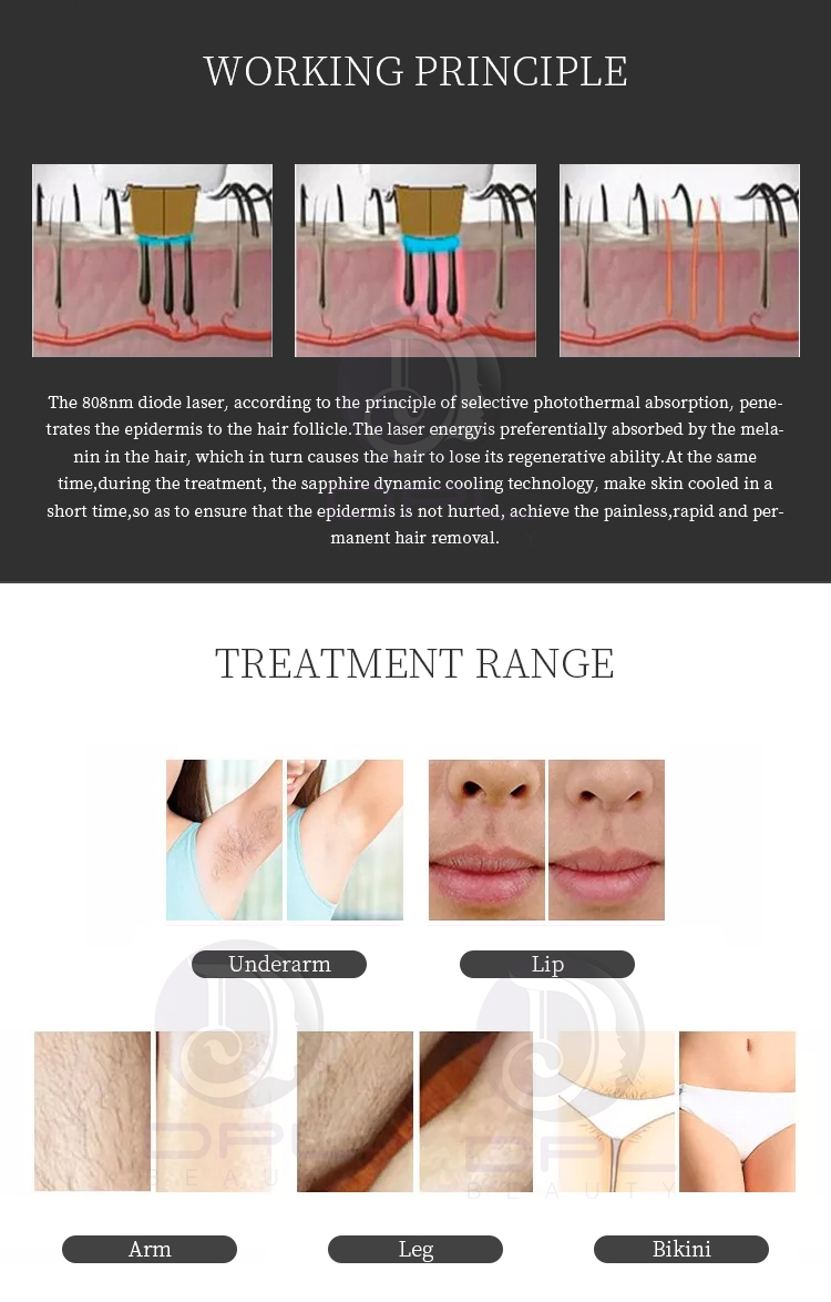 Laser Beauty Equipment 808 755 1064 diode ice laser hair removal machine pigment removal and ipl hair removal laser machine
