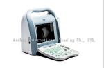 best selling ab scan a cheap ophthalmic ultrasound Eye machine