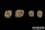 High Aesthetics Full Contour Zirconia For Crowns Bridges Implants Dental