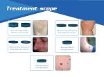 980nm diode laser machine for vascular removal, skin tag removal