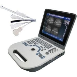 China OEM OB Obstetric Ultrasound Equipment LCD Display TGC Control on sale