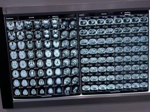 Wholesale Automatic Density X Ray Film For Medical Equipment from china suppliers