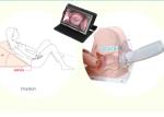 High Definition Video Gynecological Apparatus Digital Electronic Colposcope AV