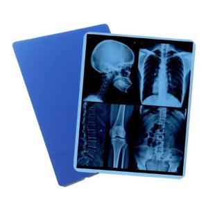 Wholesale Industry Leading Production Our Professionally Produced Medical Blue X - Ray Film For Laser Printing Is The Go - To Choice. from china suppliers