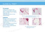Newest hifu technology / HIFUSLIM !!! NUBWAY Vacuum Cavitation System hifu body