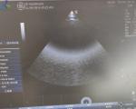 GE 9L-RS Ultrasound Probe Maintenance Replace Acoustic Lens Probe Repair
