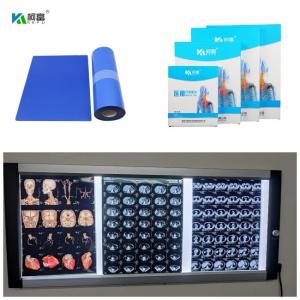 Wholesale Medical Inkjet Blue Base X Ray Film Digital Image With 210um For 14x17inch from china suppliers