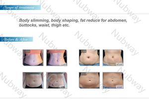 Wholesale Most and Best popular HIFUSHAPE Slimming Machine in the world from china suppliers