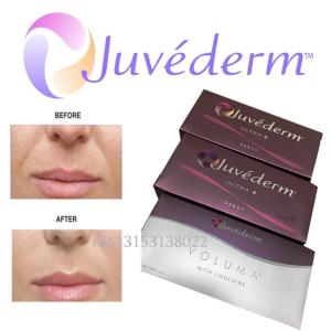 Wholesale Juvederm Ultra 3 Lidocaine Hyaluronic Acid Lip Filler Injection from china suppliers