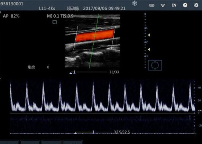 Color Doppler Ultrasound Probe Handheld Ultrasound Device For Mobilephone / PC