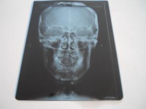 Wholesale Professional Dry Imaging Film With Image Layer 14x17inch from china suppliers