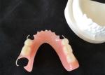 High Definition PFM Bridge Dental Colour Stability Smooth Surface
