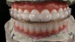 Hard & Soft Night Guard Dental Mouth Guard Hard Soft Night Guard Professional