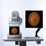 Digital OCT Fundus Camera Computer Aided For Eye Diseases