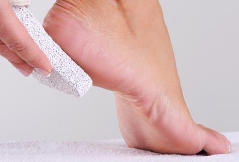 Pumice Stone - Natural Earth Lava Pumice Stone Black - Callus Remover for Feet