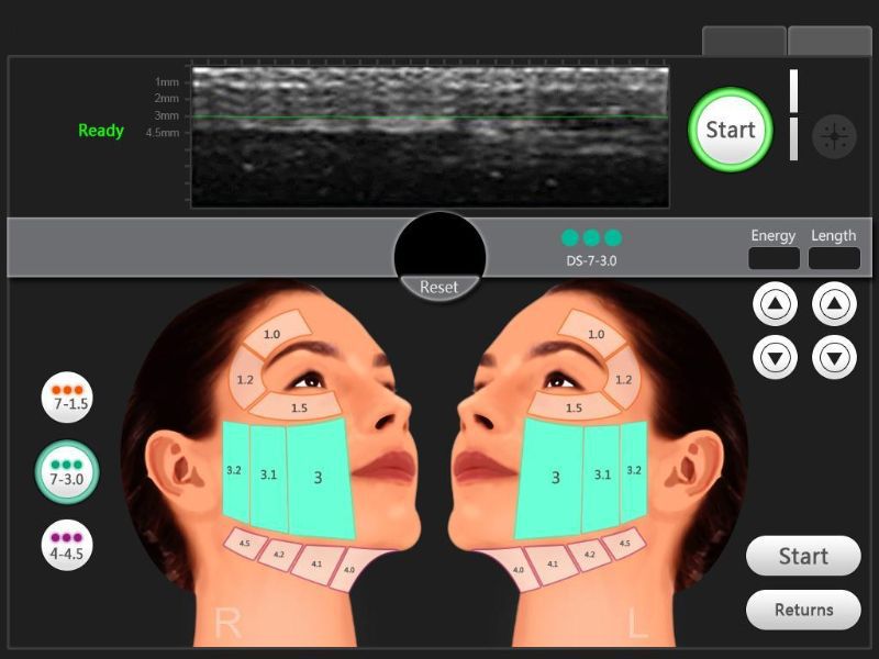 Female High Intensity Focused sound Machine Vertical for Beauty Salon