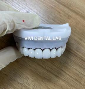 Wholesale Super White Zirconia Dental Lab Crowns 3D PRO PFZ Noritake Porcelain from china suppliers