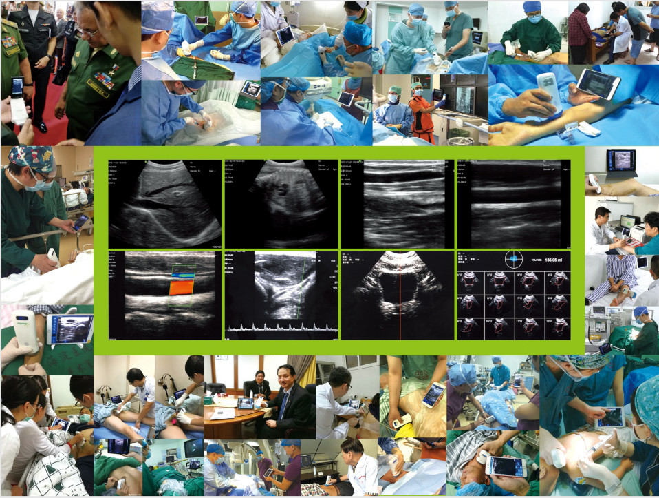 Medical Wireless Ultrasound Probe 128 Elements Color Doppler Ultrasound Wifi