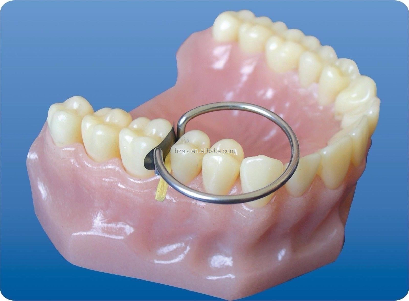 TOR VM Dental 1.340 METAL Contoured MATRICES Kit with Slot Springclip and Shelf Life 2 years