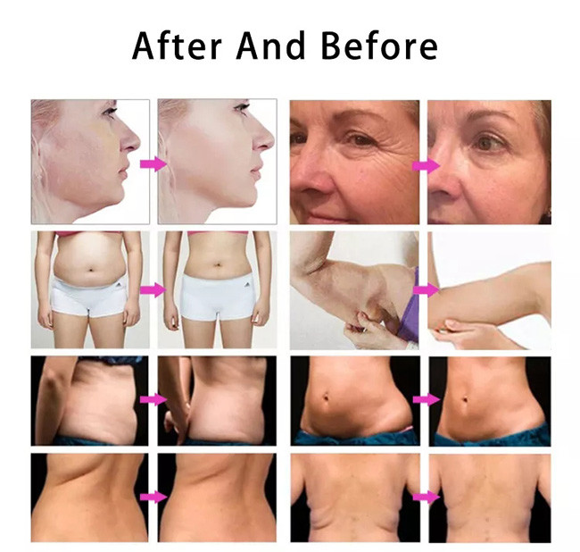 7d Beauty Product Face Lift Hifu Slimming Machine For Body And Face
