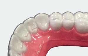Wholesale High Technology Dental Case Sheet Colorless For Aligners from china suppliers