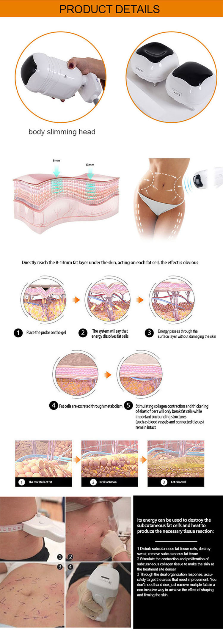 Portable MINI 4D HIFU Machine For Vagina Tighten And Face Lifting Hifu Corporal Y Facial