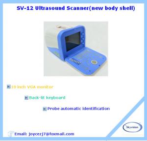 China Portable Full Digital Ultrasound Scanner on sale
