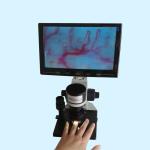 Professional Nailfold Microcirculation Microscope / Nail Checking Microscopes