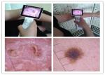Clinical ENT Inspection Of Human Body Digital Video Otoscope With Color TFT LCD