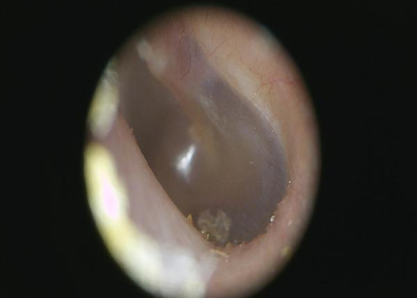 Clinical ENT Inspection Of Human Body Digital Video Otoscope With Color TFT LCD