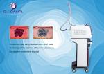 CE Approval Tattoo Removal ND YAG Laser Machine Handhold Handpiece Design
