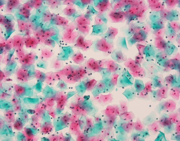 PAPANICOLAOU STAIN EA36 Baso Clear Colourful Stains for Cell Colouring
