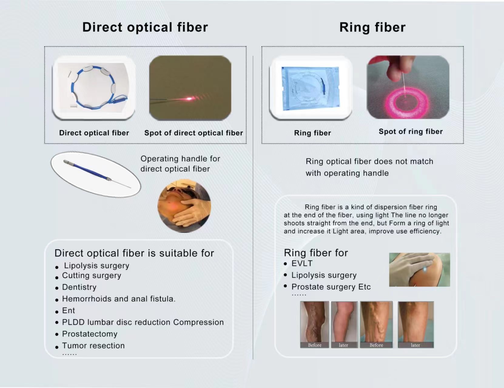 Effortless Hips Treatment With Touch Screen Laser Lipolysis Machine And Air Cooling System