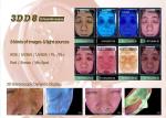 observ 10 meicet beauty equipment 360 hd camera reval smart mirror skin