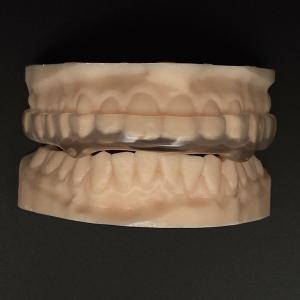 Wholesale Clear Hard Soft Orthodontic Night Guard Breathability Heavy Duty Protection Occlusal Splint Hard/Soft from china suppliers