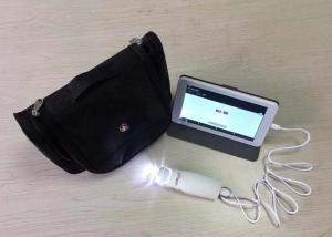 China Vaginal Videoscope Digital Video Colposcope Connected to Computer / TV with 3 Million Pixels to Take Photo for Cervix on sale