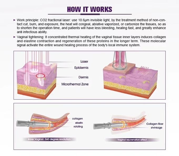 GOMECY 2024 Facial Skin Care Co2 Fractional Laser Stretch Mark Fractional Co2 Laser For Warts Scars Birthwarks Removal