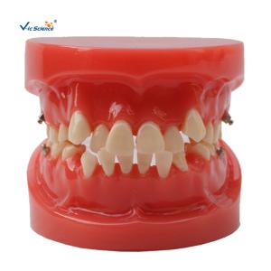 Wholesale Orthodontic Dental Study Models Tooth Teaching , Dental Models For Patient Education from china suppliers