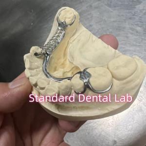 Wholesale Skelete Chrome Cast Partial Denture Metal Framework ISO from china suppliers