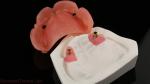Dentsply Lucitone 199 Acrylic Denture For Full Arch Natural Look