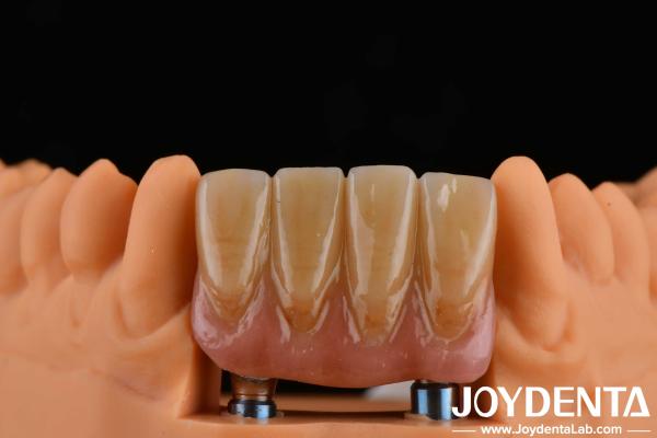 4.5mm Height Finished Abutments Internal Hex Connection Type Compatible With