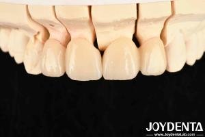 Wholesale High Translucency Layered Zirconia 3 W/mK Thermal Conductivity For Exceptional Performance from china suppliers