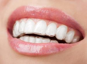 Wholesale 17*18cm TPU Transparent Dental Sheet Anti Fouling Tooth Orthodontics Material from china suppliers
