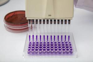 Wholesale Liquid Handling Medical Device Moulding Multi-Cavity Micro Pipette Molds plastic injection molding automotive parts from china suppliers