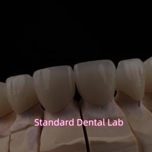 Wholesale PFZ Dental Layered Ceramic Zirconia Bridge With Incisal Translucent from china suppliers