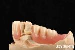 Lightweight Good Biocompatibility Acrylic Denture Finish Personalized Customizat