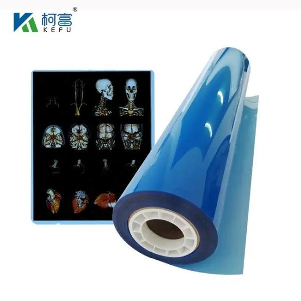 High Definition And Wide Gamut Medical Laser Film 17x22in 0.17mm For Detailed