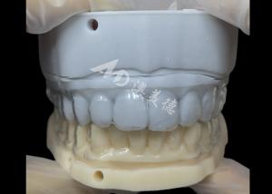 Wholesale Orthodontic retainer　Essix Retainer Simple And Versatile Correction from china suppliers