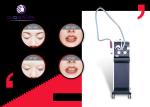 532nm 1064nm Portable Tattoo Removal Machine 1500w High - Tech Easy Operation