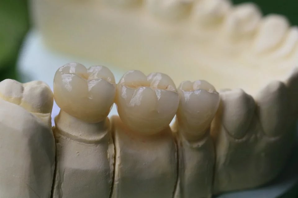 Dental Laboratory Zirconium Oxide Porcelain Zirconia Dental Crown With Ceramic